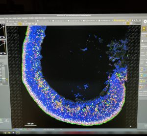 Retinal Organoids